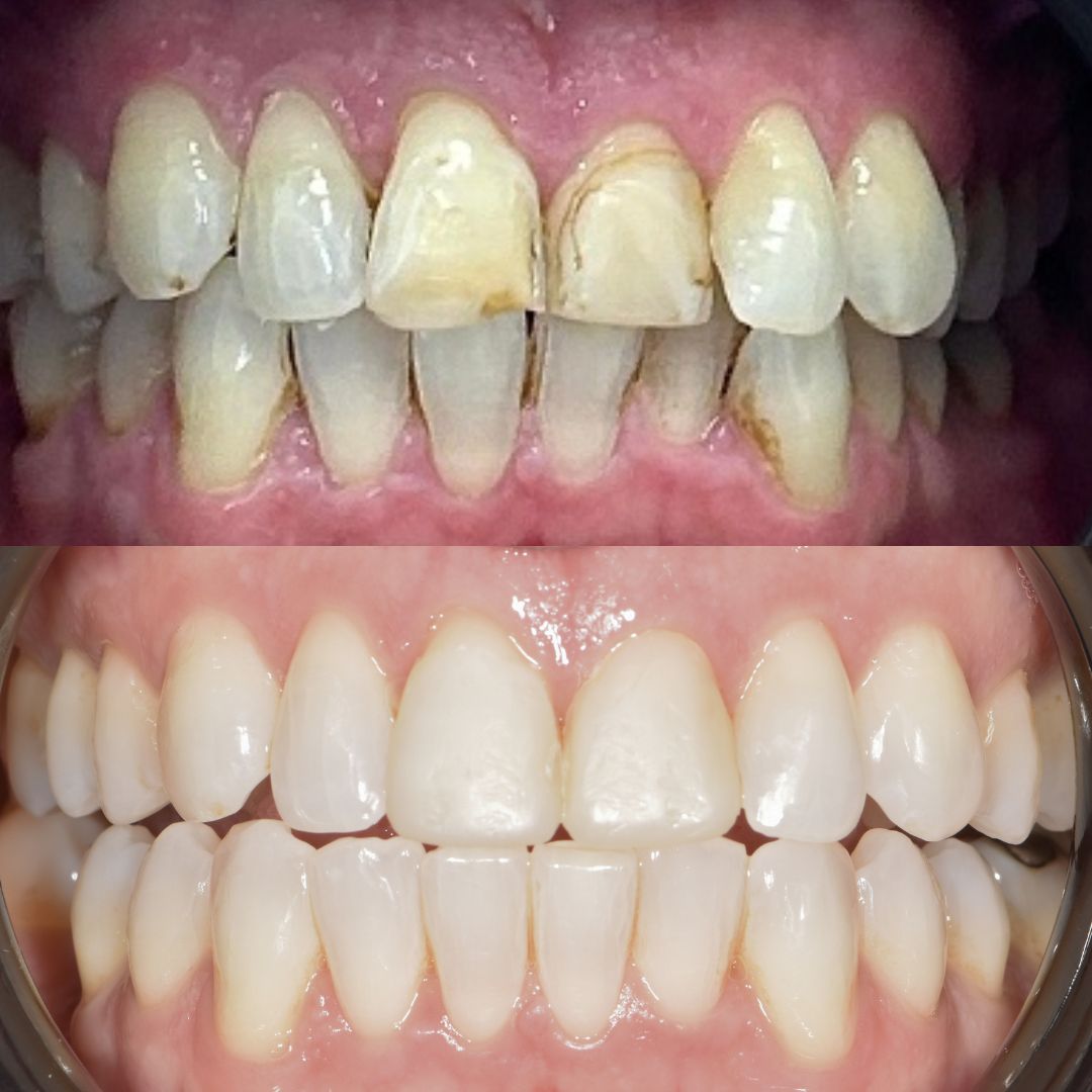 Ravenhill Dental Care Welcome To Raven Hill Dental Practice Ravenhill Dental Care B&As