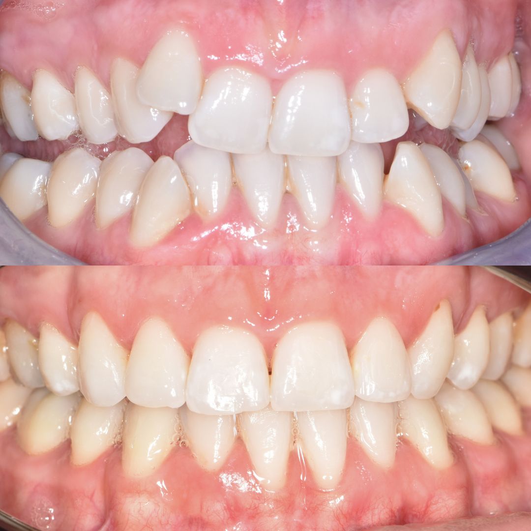 Ravenhill Dental Care Welcome To Raven Hill Dental Practice Ravenhill Dental Care B&As