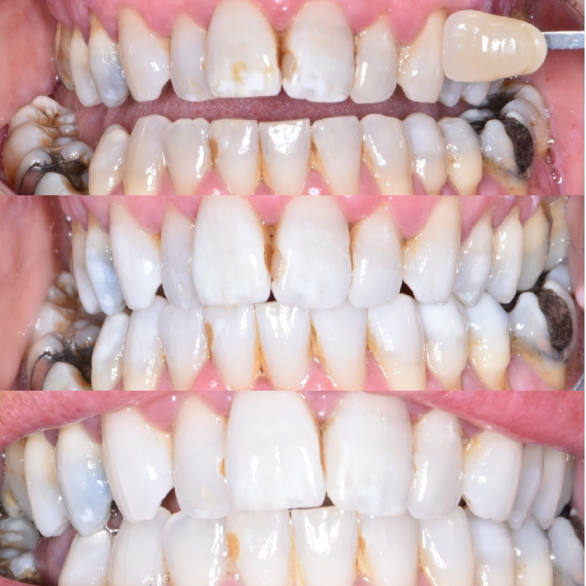 Ravenhill Dental Care Welcome To Raven Hill Dental Practice Ravenhill Dental Care B&As